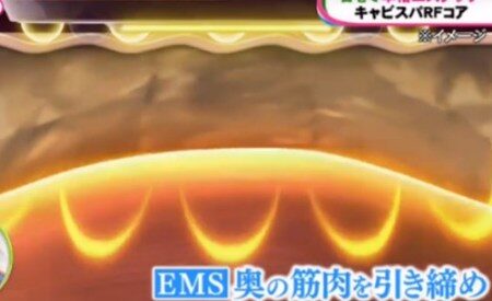 ノンストップ