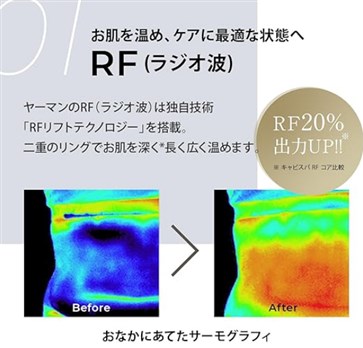 ラジオ波の出力が旧モデルよりUP！