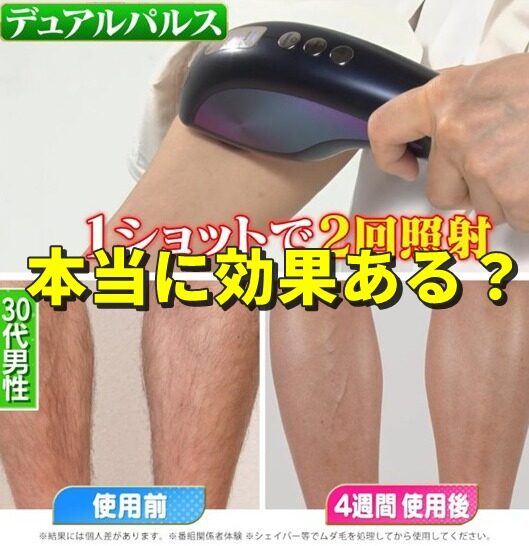 エクストラスキン